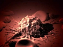 癌癥、白血病越來越多，是因?yàn)闀r(shí)代在進(jìn)步而導(dǎo)致的嗎？